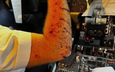 United Airlines pilot injured after unknown object shatters cockpit windshield at 36,000 feet