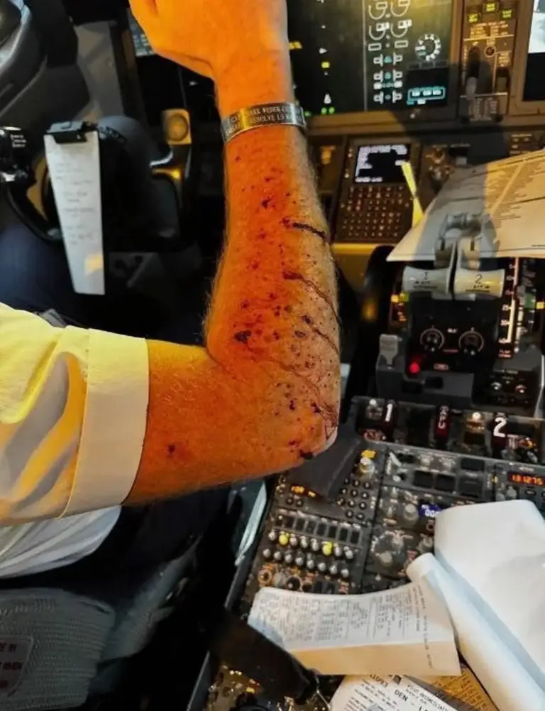 United Airlines pilot injured after unknown object shatters cockpit windshield at 36,000 feet