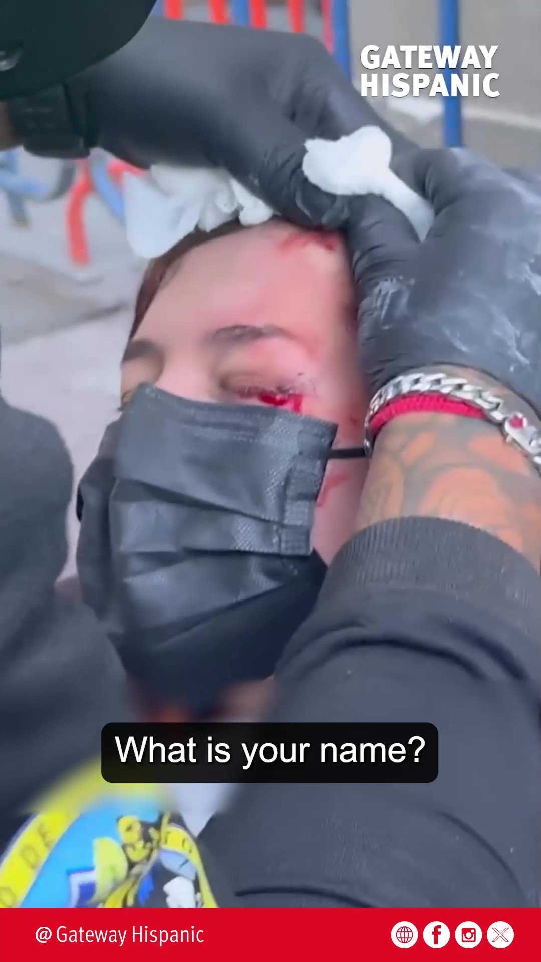 A person receiving medical attention for a facial injury while being asked their name, with a focus on the caregiver's hands and facial expression.