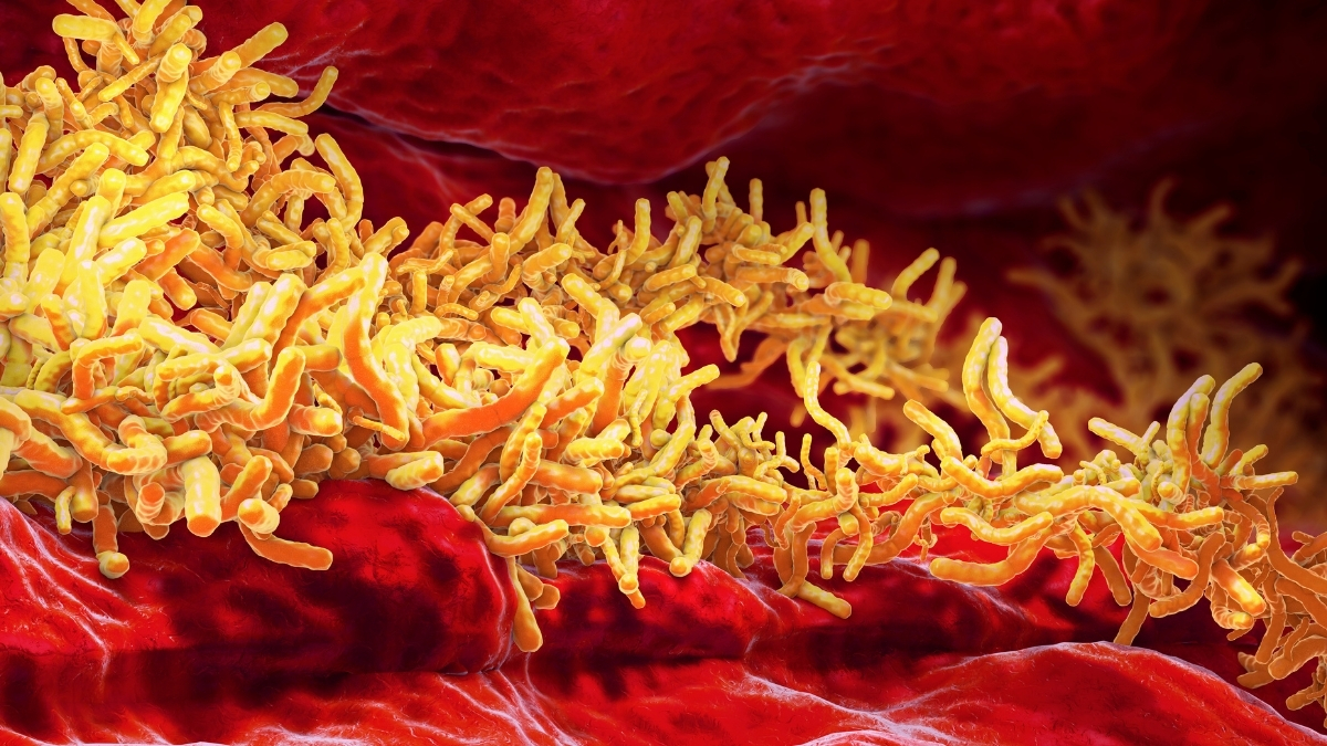 World’s Top Infectious Killer Claimed 1.23 Million Lives Last Year, WHO Says