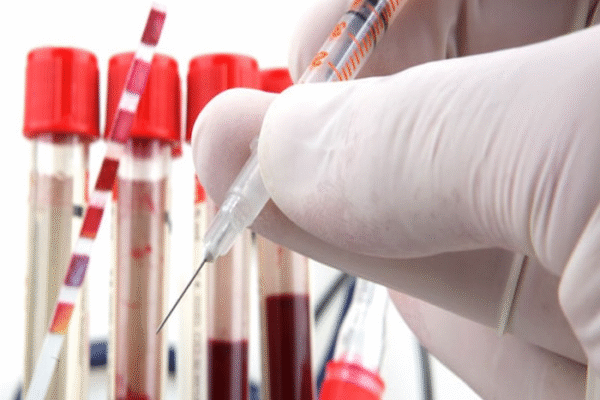 Blood Test Suicide Prediction Genuine Concern or Big Pharma Money Grab?