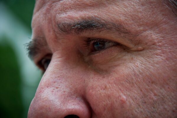 New stem cell treatment shows promise for reversing vision loss in macular degeneration patients