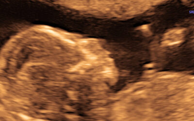 Puerto Rico Enacts Groundbreaking Law Recognizing Unborn Babies as Persons from Conception