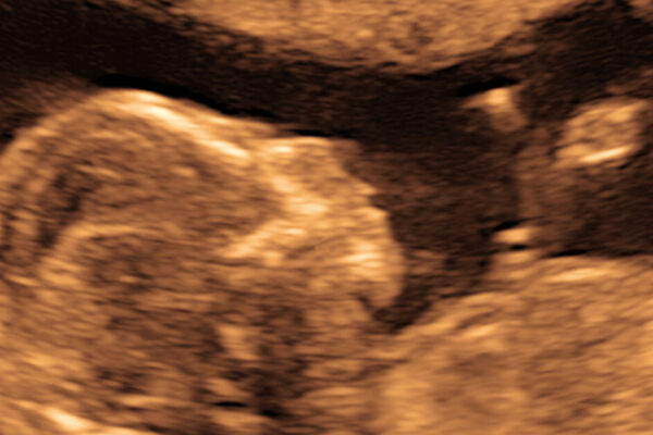 Puerto Rico Enacts Groundbreaking Law Recognizing Unborn Babies as Persons from Conception