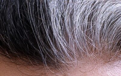 Stress Can Turn Hair Gray — And It’s Reversible, Researchers Find