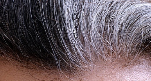 Stress Can Turn Hair Gray — And It’s Reversible, Researchers Find