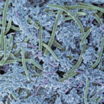 Mesosil’s infection-fighting dental tech gets FDA clearance