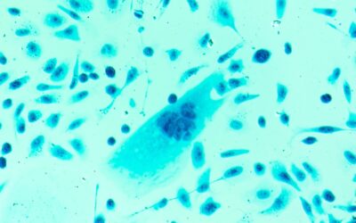 A new drug is producing “stunning” results in men with advanced prostate cancer