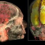First MRI scan video of female orgasm shows how activity lights up like a Christmas tree article-2062748-0ED8324200000578-484_308x185