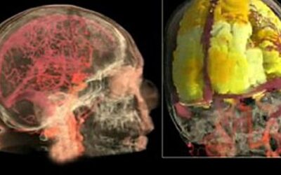 First MRI scan video of female orgasm shows how activity lights up like a Christmas tree