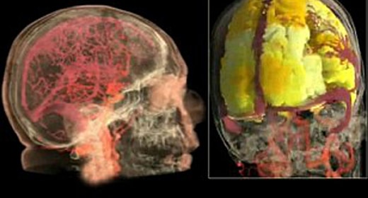 First MRI scan video of female orgasm shows how activity lights up like a Christmas tree