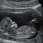 Abortion Providers Don’t Deserve Our Appreciation screen-shot-2025-07-26-at-15027-pm_16x9-1200x630-1