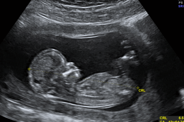 Abortion Providers Don’t Deserve Our Appreciation