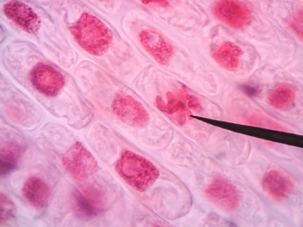 How screening and vaccines drove UK cancer deaths to record lows