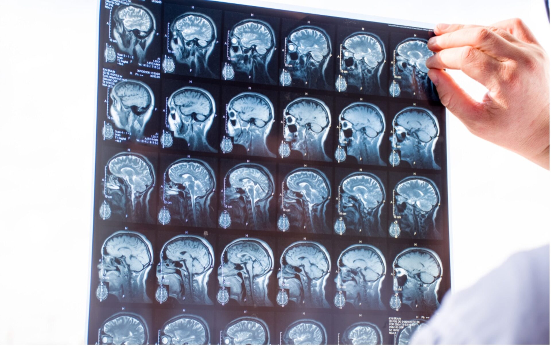 What Makes Traumatic Brain Injury Cases More Complex Than Other Injury Claims –