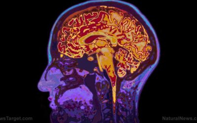 88% of Americans worry about memory loss, but only 9% know how to protect brain health