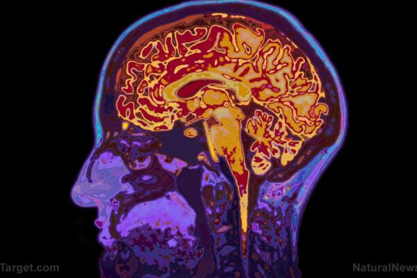 88% of Americans worry about memory loss, but only 9% know how to protect brain health