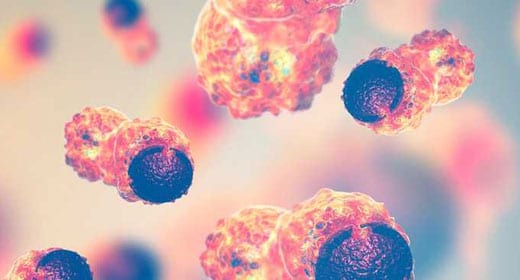 Top 5 Cancer Stem Cell-Killing Foods