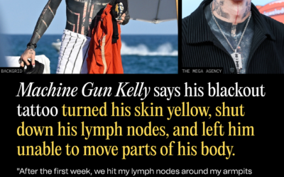 Machine Gun Kelly Says His Blackout Tattoo Turned His Skin Yellow, Shut Down His Lymph Nodes, and Left Him Unable to Move Parts of His Body