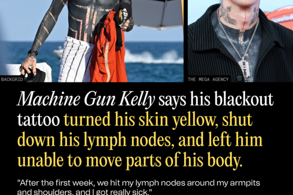 Machine Gun Kelly Says His Blackout Tattoo Turned His Skin Yellow, Shut Down His Lymph Nodes, and Left Him Unable to Move Parts of His Body
