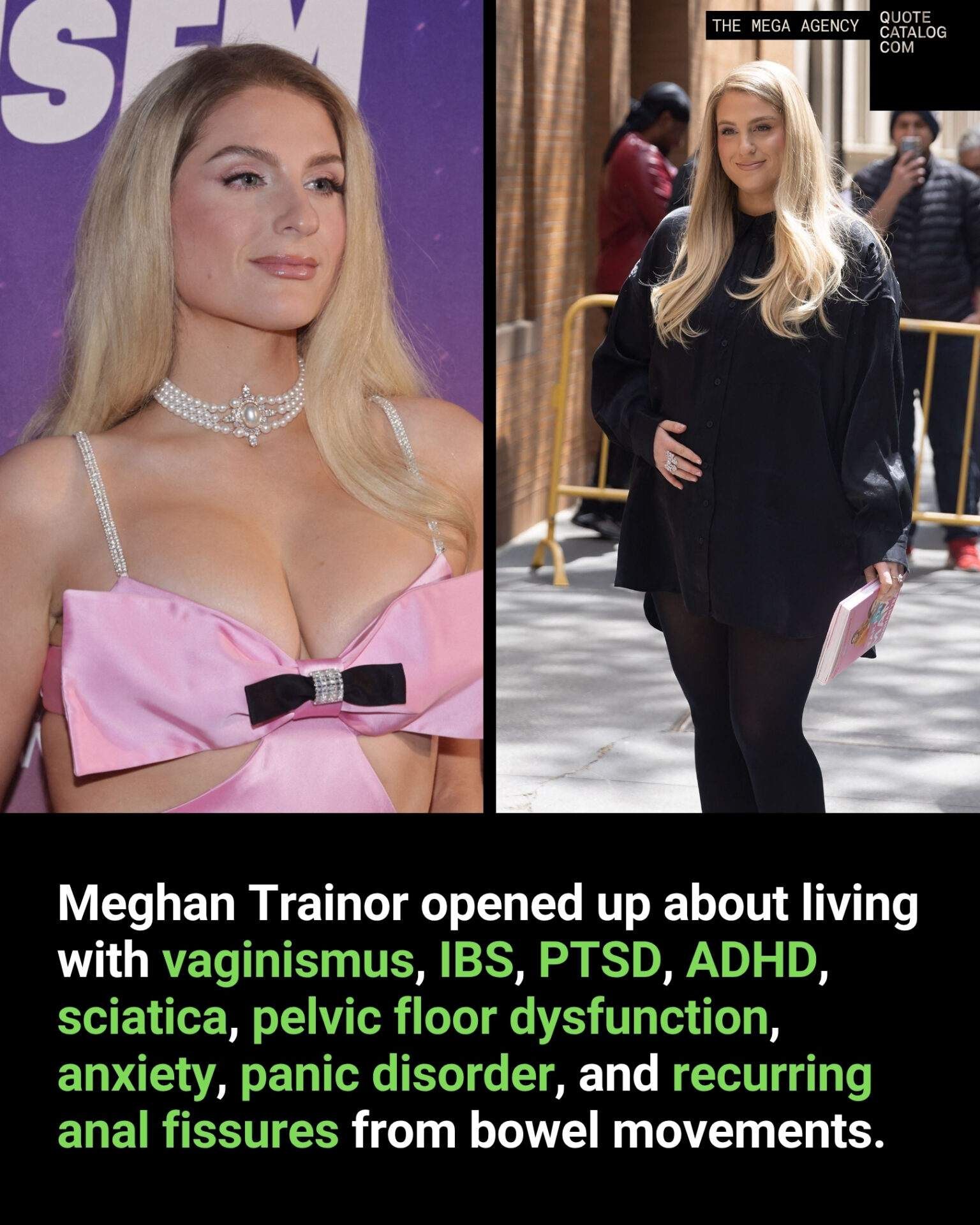 Meghan Trainor Opened Up About Living with Vaginismus, IBS, PTSD, ADHD, Sciatica, Pelvic Floor Dysfunction, Anxiety, Panic Disorder, and Recurring Anal Fissures from Bowel Movements