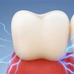Understanding Tooth Sensitivity and How to Stop It at the Root tooth-sensitivity-causes-and-remedies-thumbnail