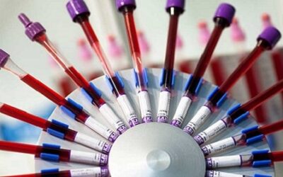 Does Science Support The Blood Type Diet?