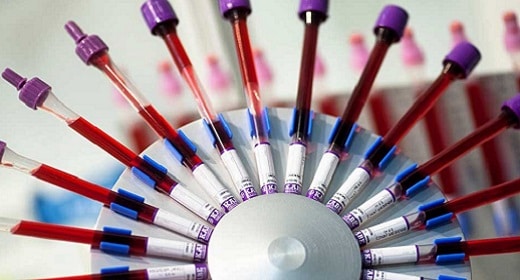 Does Science Support The Blood Type Diet?