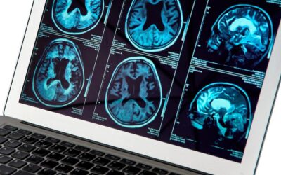 Copper compound targets Alzheimer’s at the blood-brain barrier