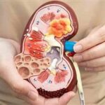Chronic Kidney Disease: A Hidden Threat to Your Heart chronic-kidney-disease-heart-health-thumb