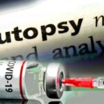 FDA Reviewed Autopsies of Children Who Died After COVID Vaccines, Reduced Number From 10 to 7 fda-autopsy-children-covid-vaccines-1024x534-1