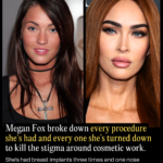 megan-fox-then-vs-now-the-full-list-of-procedures-she-s-confirmed-and-the-ones-s-2