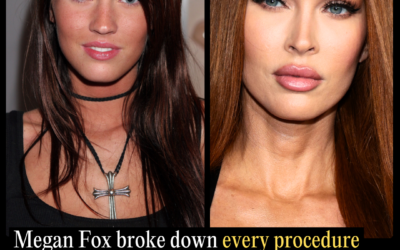 Megan Fox Then vs. Now: The Full List of Procedures She’s Confirmed and the Ones She’s Declined