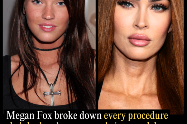 Megan Fox Then vs. Now: The Full List of Procedures She’s Confirmed and the Ones She’s Declined
