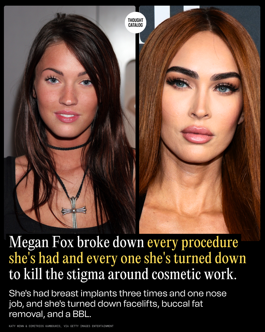 Megan Fox Then vs. Now: The Full List of Procedures She’s Confirmed and the Ones She’s Declined