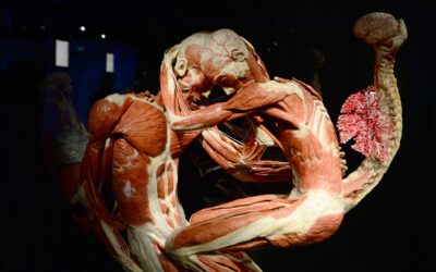 Gunther Von Hagens, the Body Worlds Creator, Died at 81 and Will Be Plastinated per His Own Plans