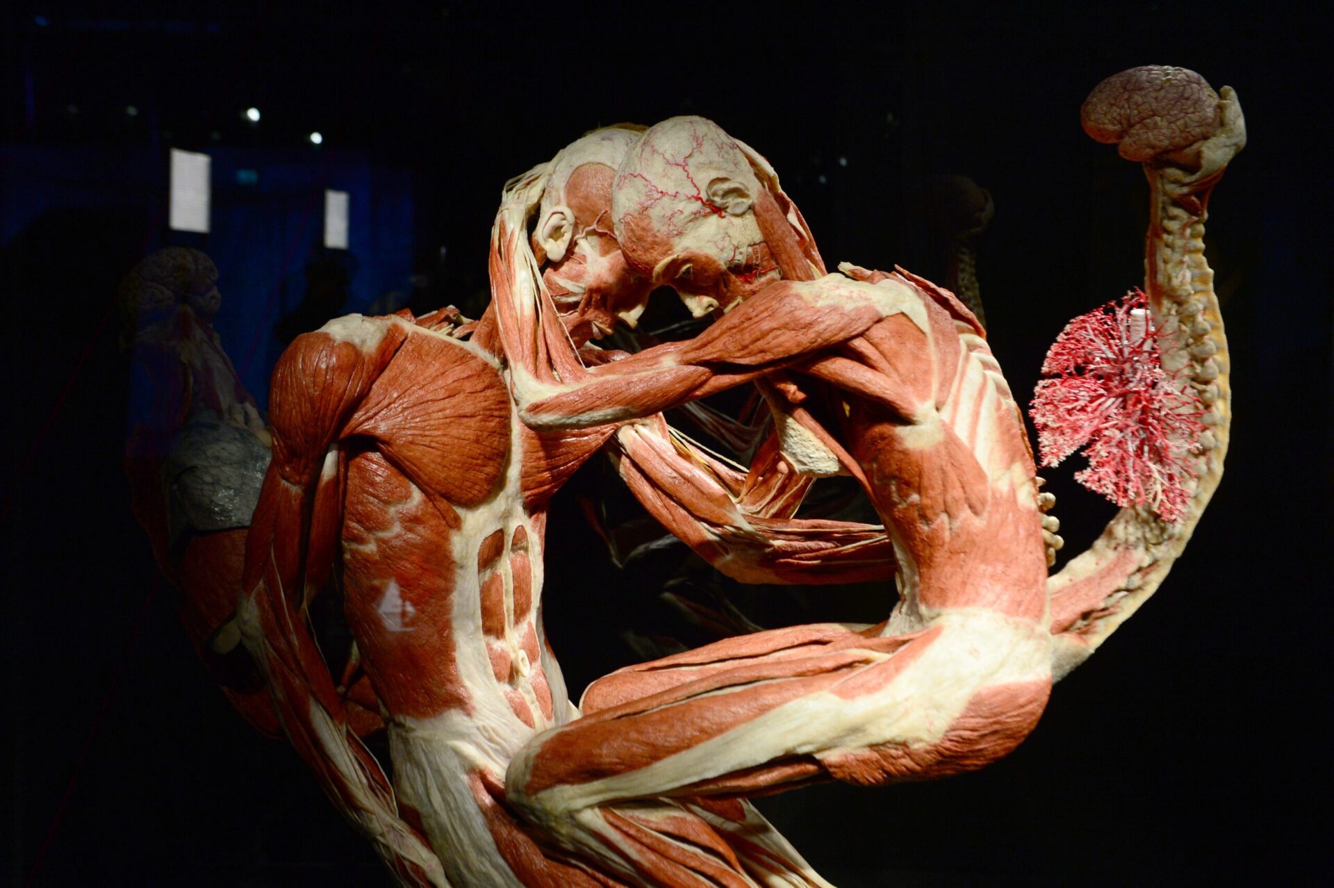 Gunther Von Hagens, the Body Worlds Creator, Died at 81 and Will Be Plastinated per His Own Plans