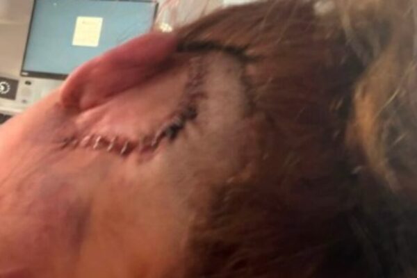 HORROR: Man Allegedly Beats DoorDash Driver and Mom of Three in Shocking Road Rage Incident, Leaving Her with Horrific Brain Injuries