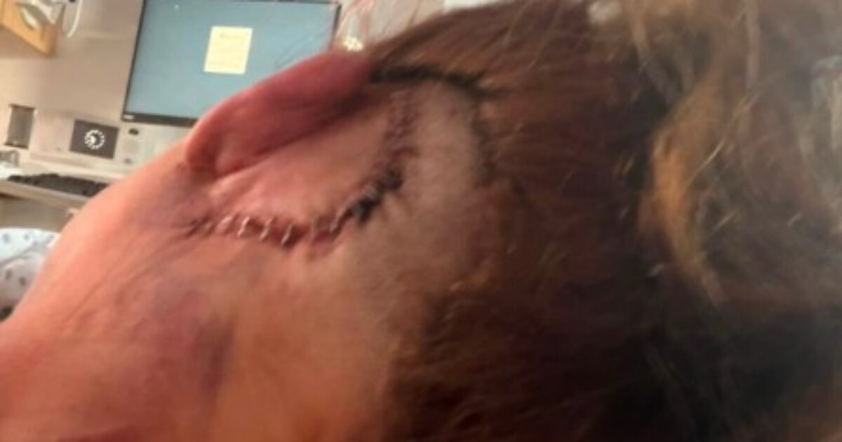HORROR: Man Allegedly Beats DoorDash Driver and Mom of Three in Shocking Road Rage Incident, Leaving Her with Horrific Brain Injuries