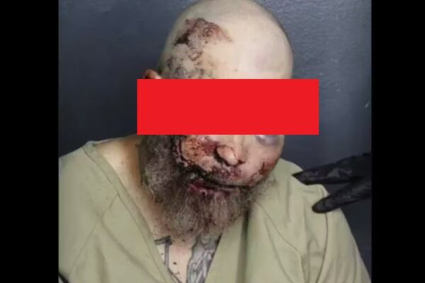 Whoa: Florida Man’s Mugshot After He Allegedly Tried to Fight Cop Tells the Story Itself